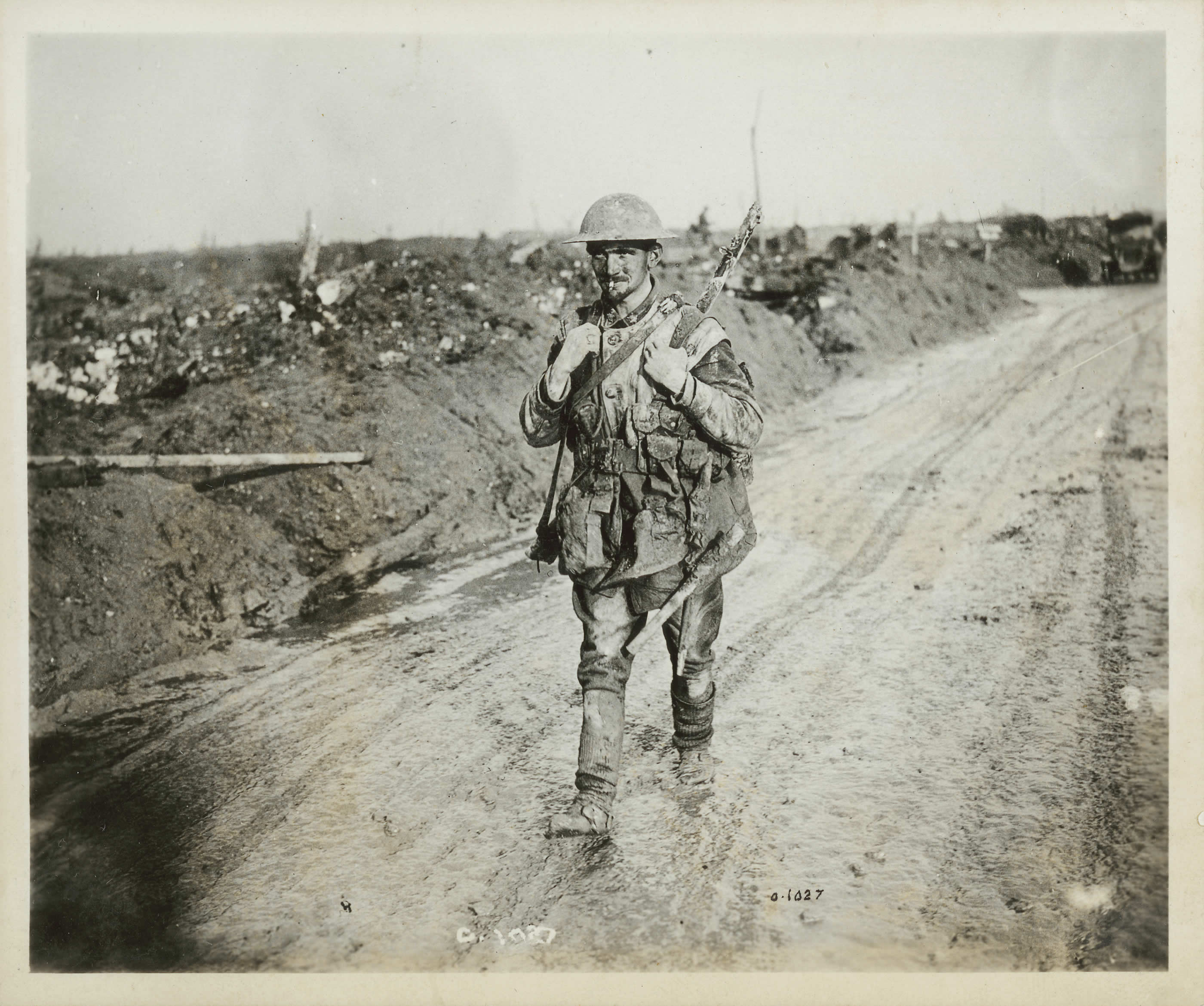 World War 1 Trench Mouth